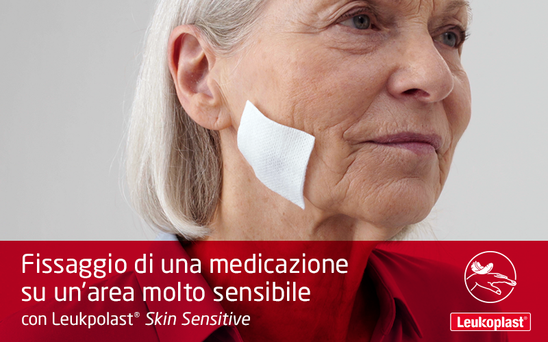 Qui vediamo come applicare e riposizionare una medicazione su un'area molto sensibile, utilizzando un cerotto su rocchetto: un operatore sanitario fissa un tampone sulla guancia di una signora con pelle fragile con l'aiuto di Leukoplast Skin Sensitive. Qui vediamo come applicare e riposizionare una medicazione su un'area molto sensibile, utilizzando un cerotto su rocchetto: un operatore sanitario fissa un tampone sulla guancia di una signora con pelle fragile con l'aiuto di Leukoplast Skin Sensitive.